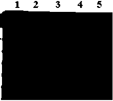 Preparation method of high purity and low density lipoprotein