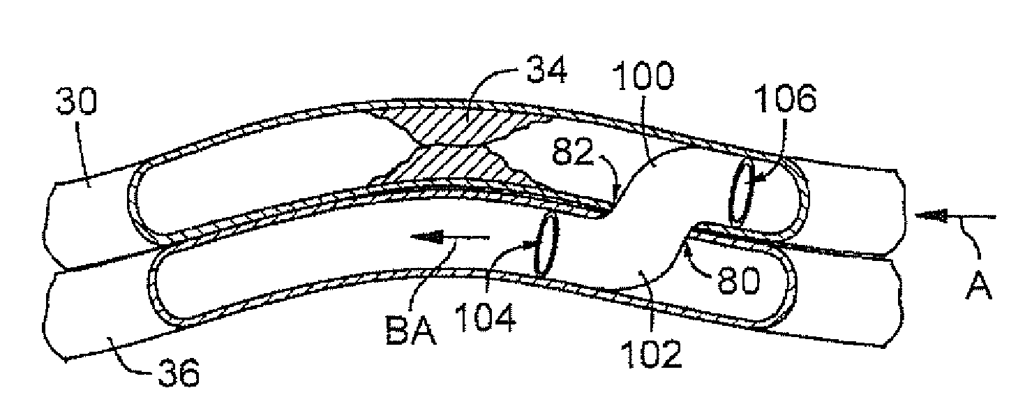 Catheter system with stent apparatus for connecting adjacent blood vessels