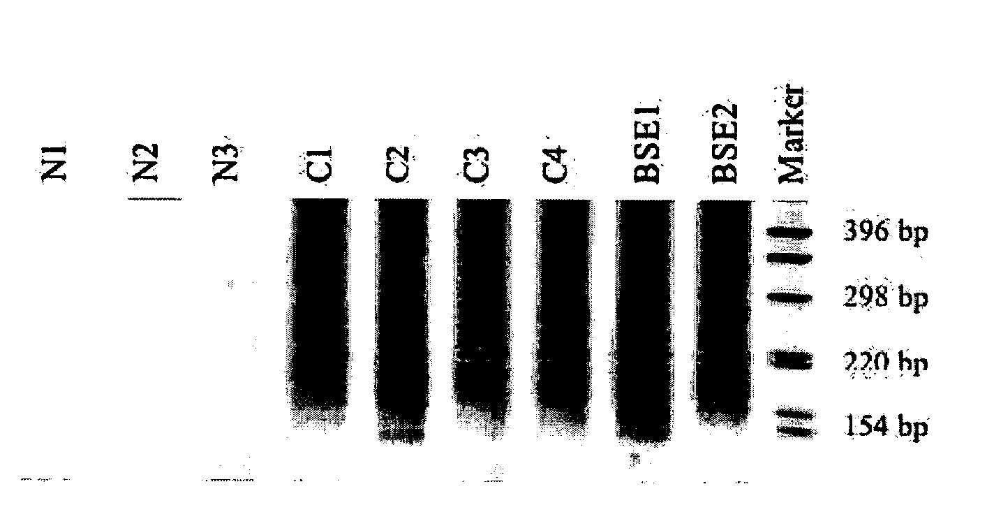 Detection of nucleic acids to assess risk for bovine spongiform encephalopathy