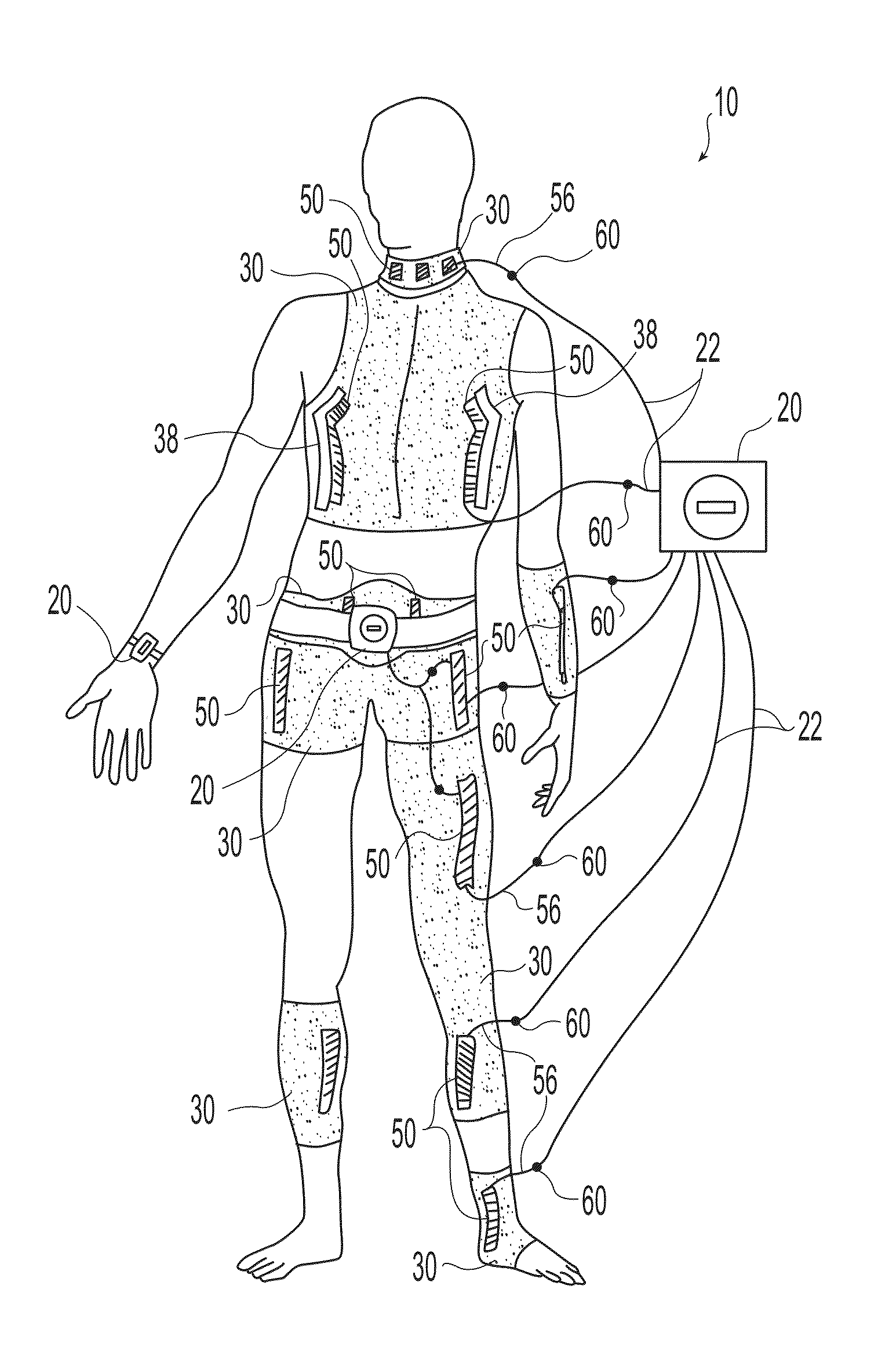 Neuromuscular stimulation system