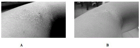 Inflammation-inhibition antisensitization preparation prepared from Euryale ferox seed shell as main component and use thereof