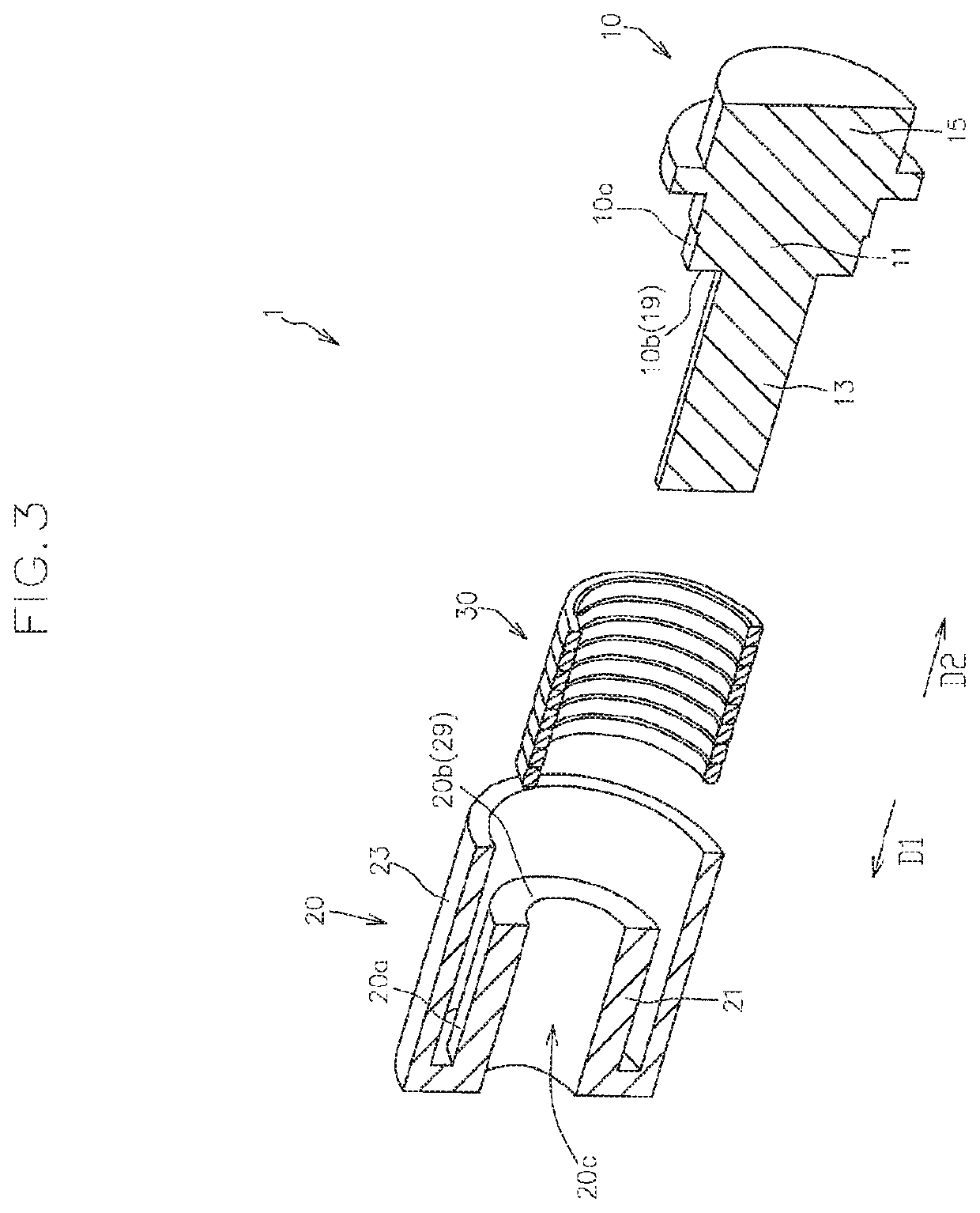 Torque limiter