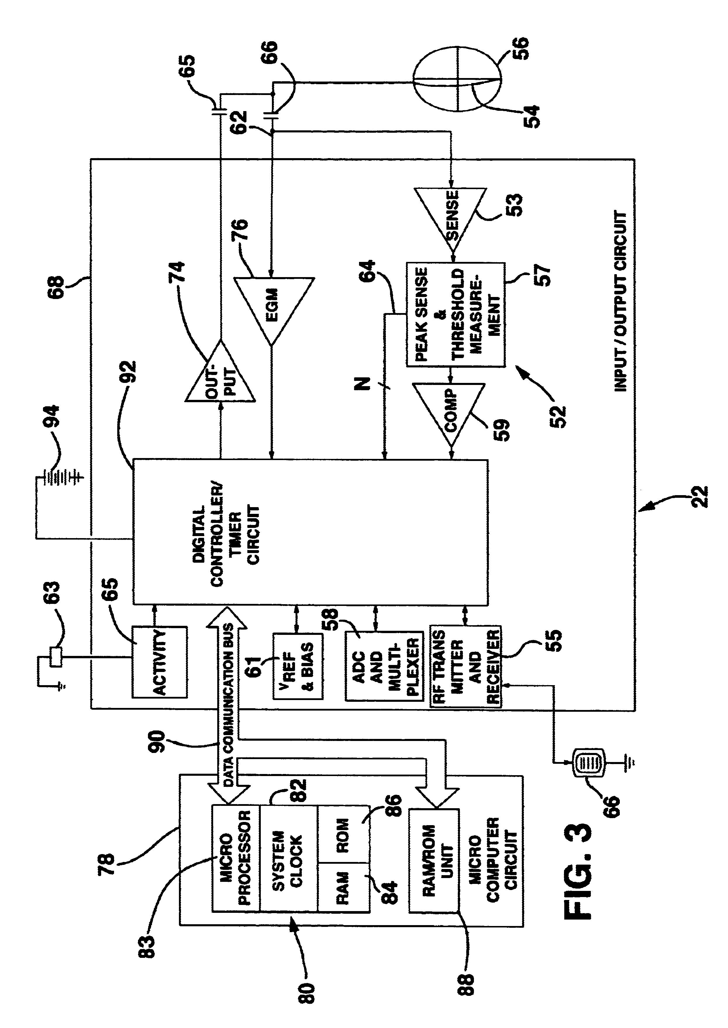 Method and system for myocardial infarction repair