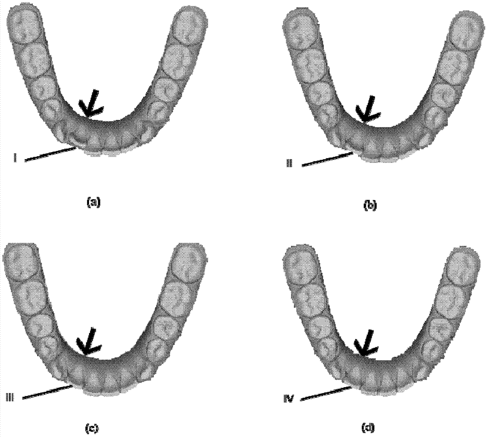 Manufacturing method for invisible orthotic device