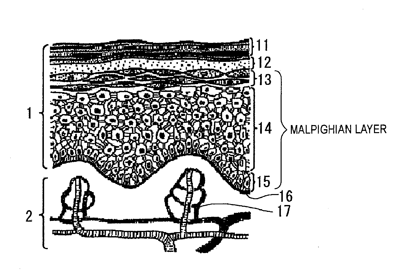 Living-tissue pattern detecting method, living-tissue pattern detecting device, biometric authentication method, and biometric authentication device