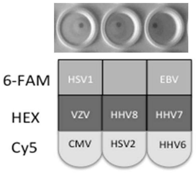 Solid-phase multiplex row PCR detection kit and detection method for infectious eye disease pathogens