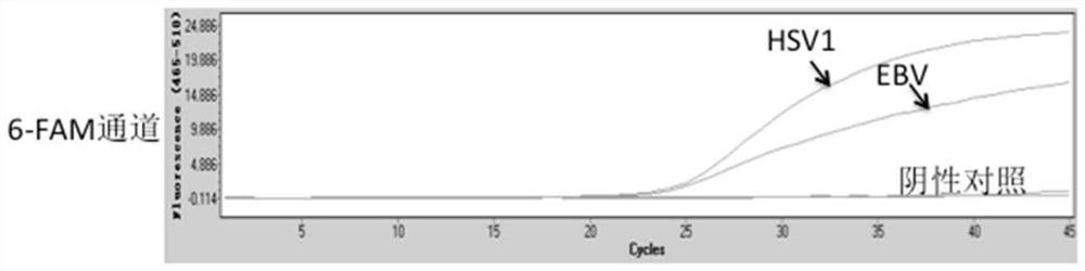 Solid-phase multiplex row PCR detection kit and detection method for infectious eye disease pathogens