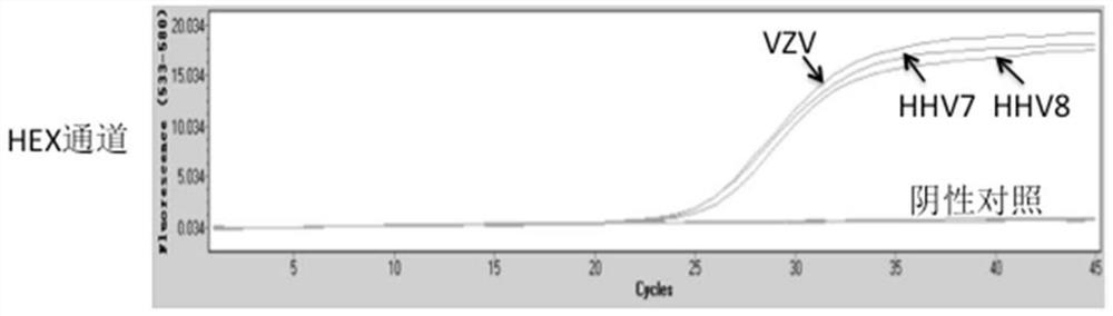 Solid-phase multiplex row PCR detection kit and detection method for infectious eye disease pathogens