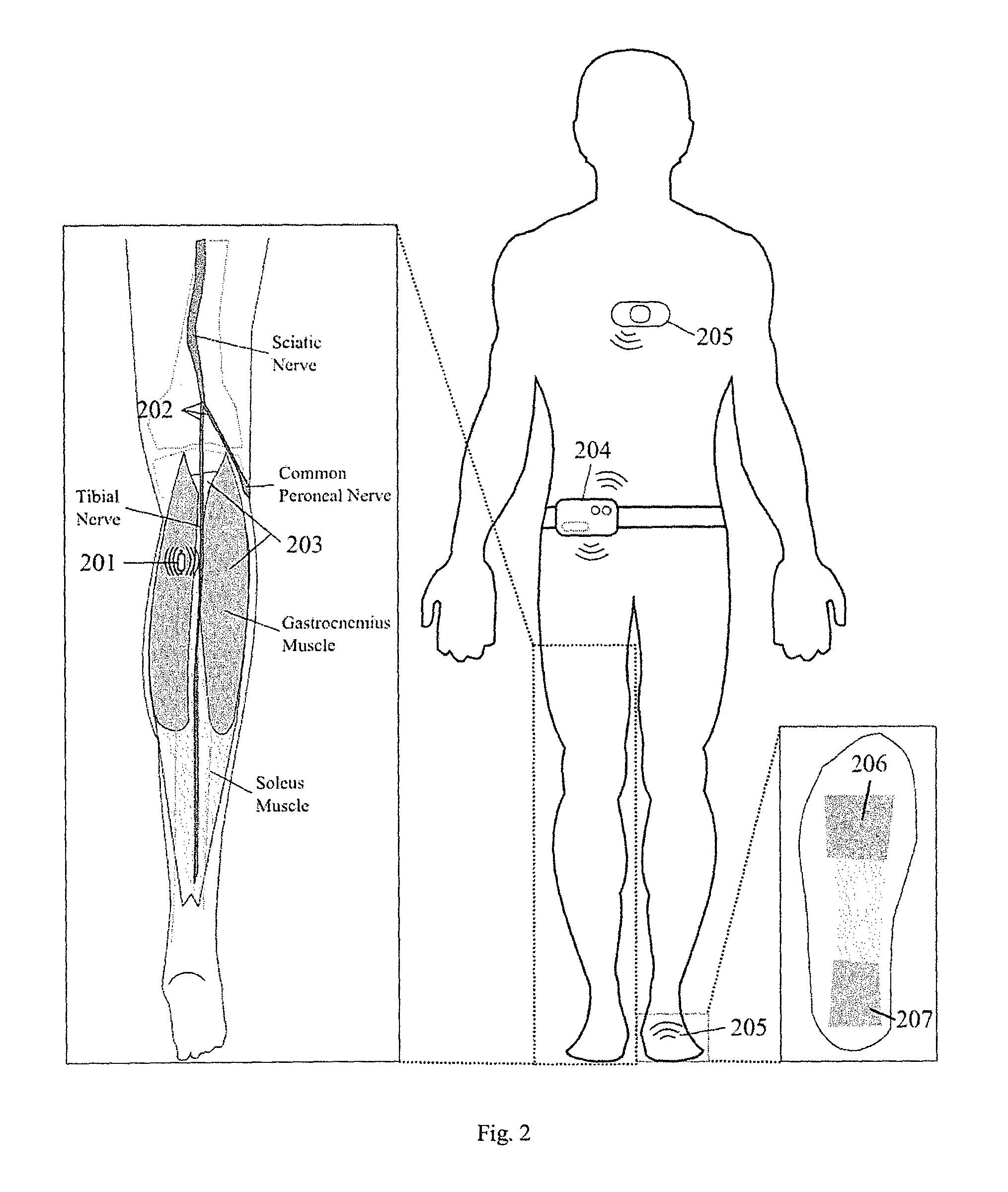 Apparatus and methods for prevention of syncope