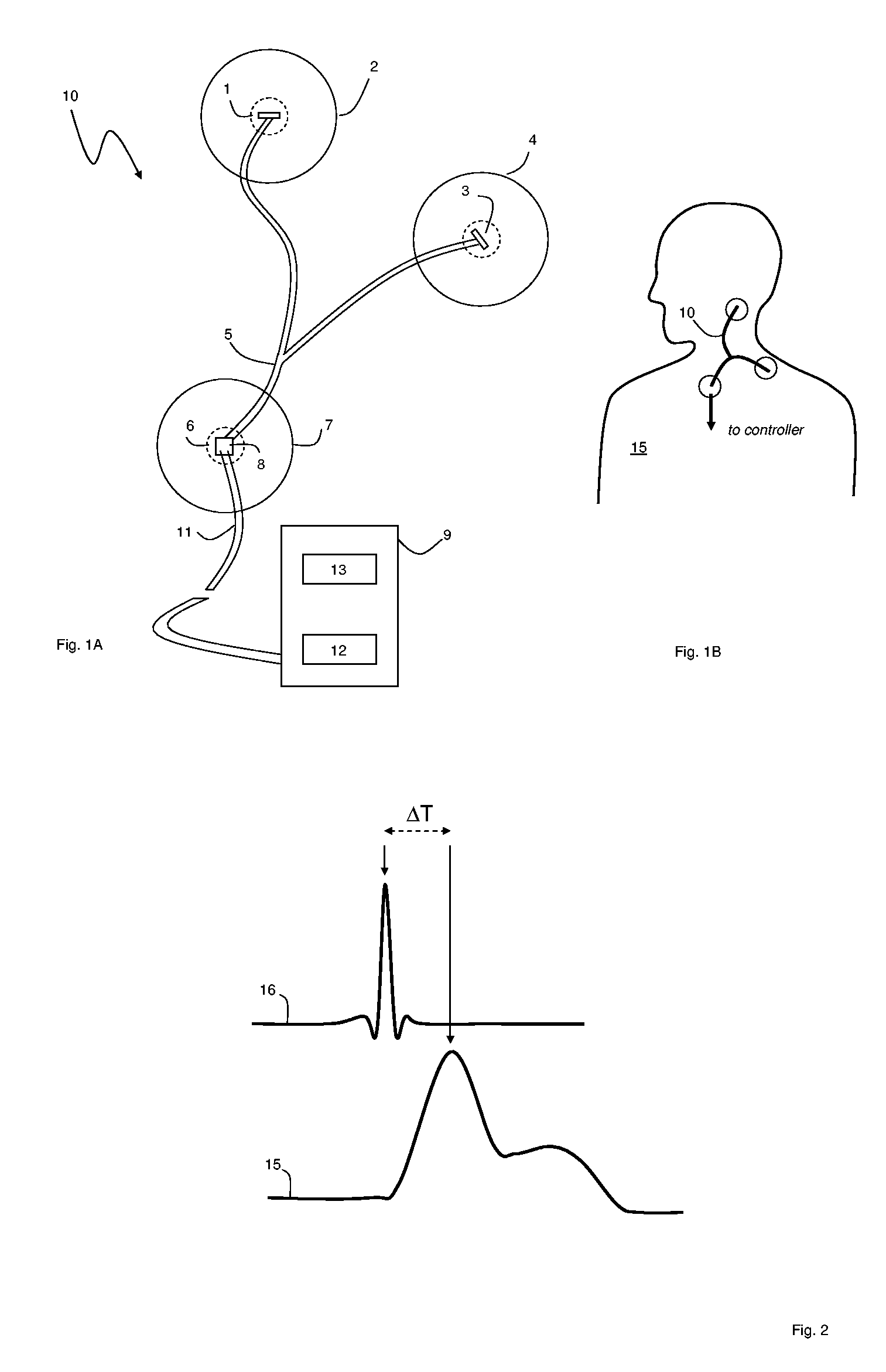 Patch sensor system for measuring vital signs