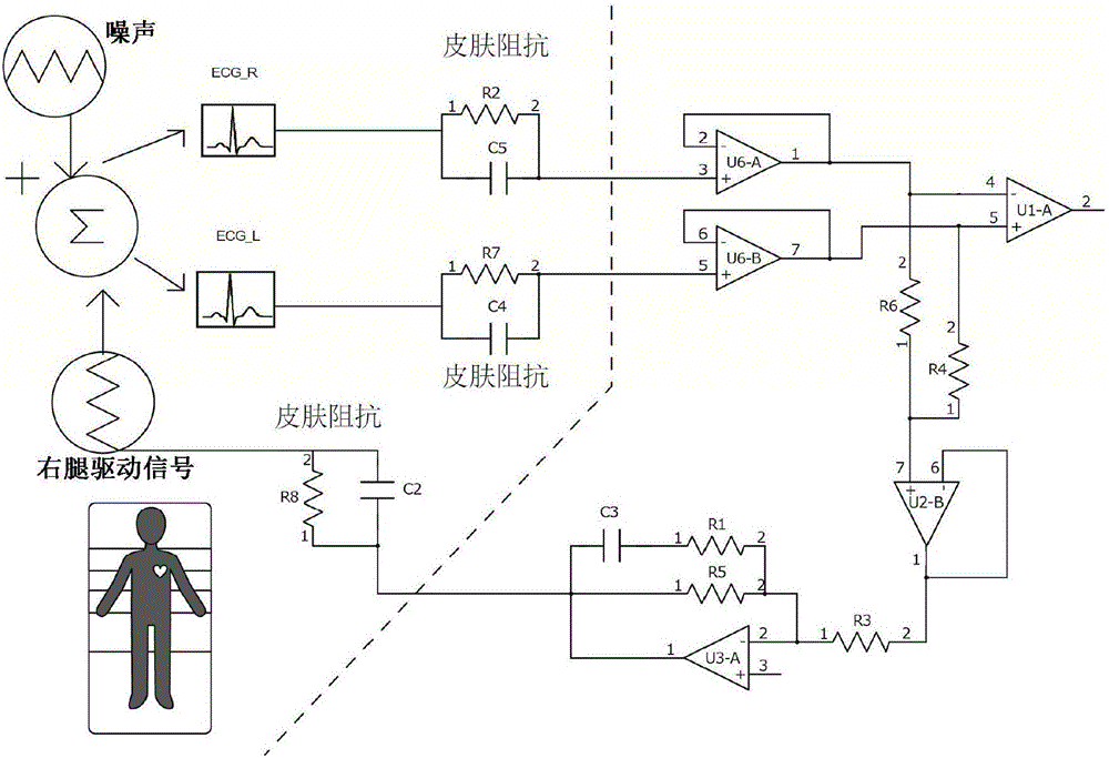 Electrocardiograph detection system