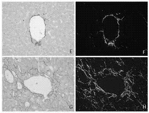 Dyeing method for observing collagenous fibers by adopting polarization microscope