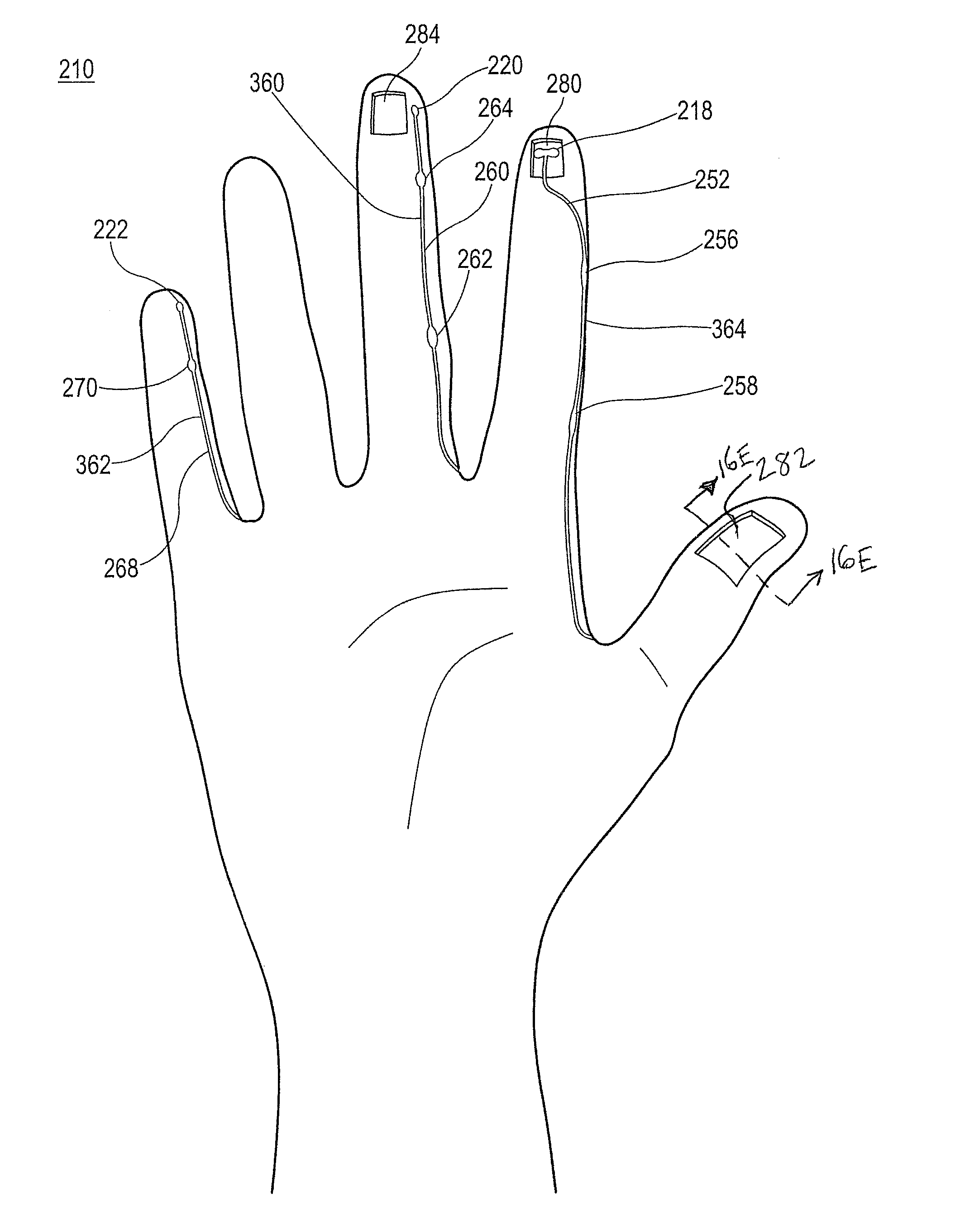 Method of making polymeric gloves having embedded surgical support systems and discrete elements