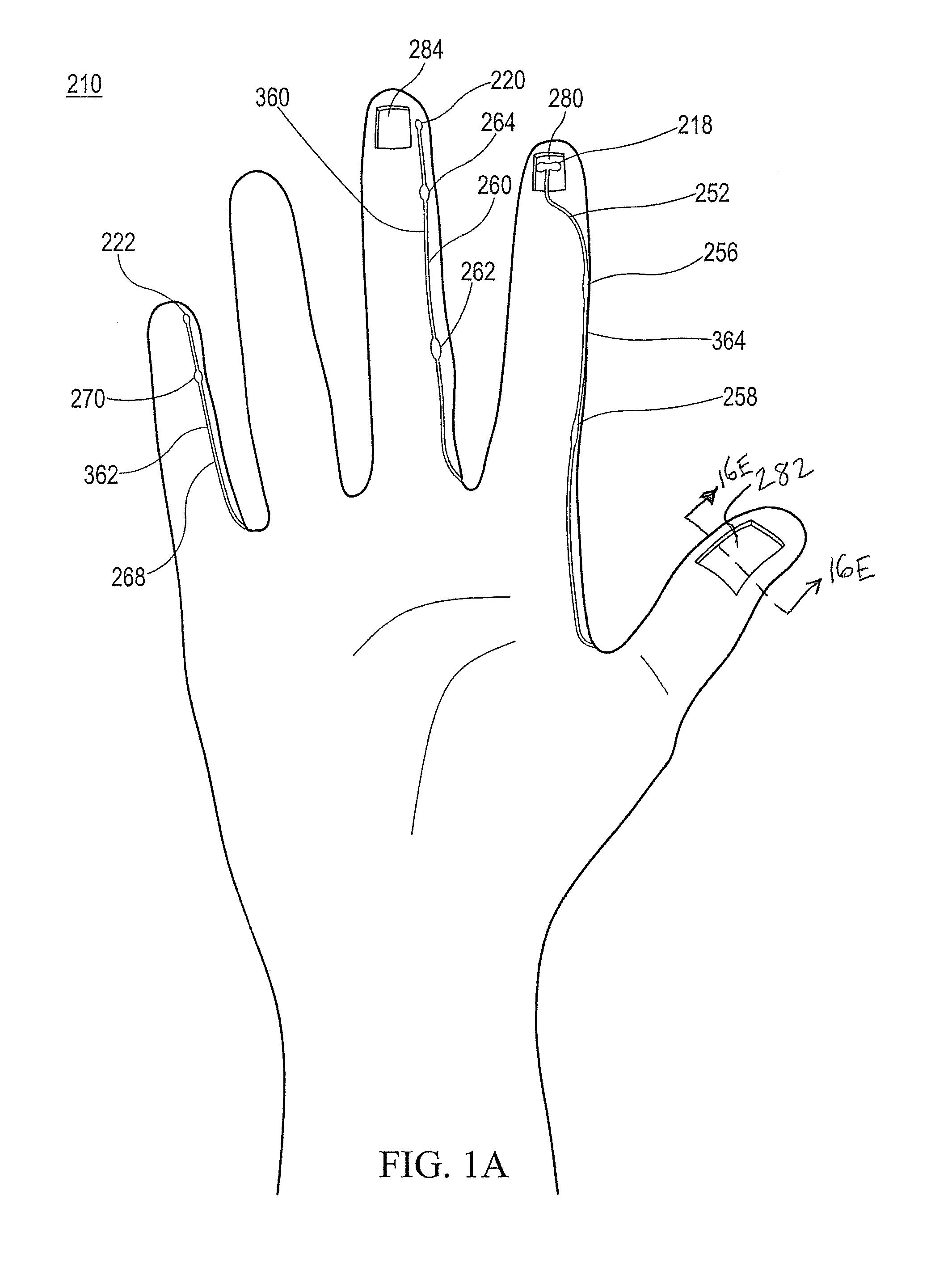 Method of making polymeric gloves having embedded surgical support systems and discrete elements