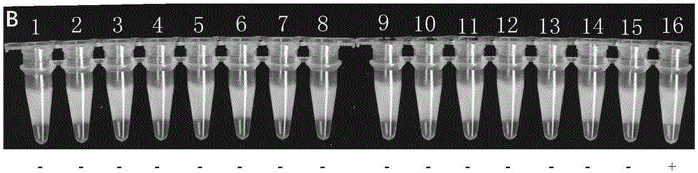 LAMP (loop-mediated isothermal amplification) kit for detection of mycoplasma pneumoniae and special LAMP primer for detection of mycoplasma pneumoniae