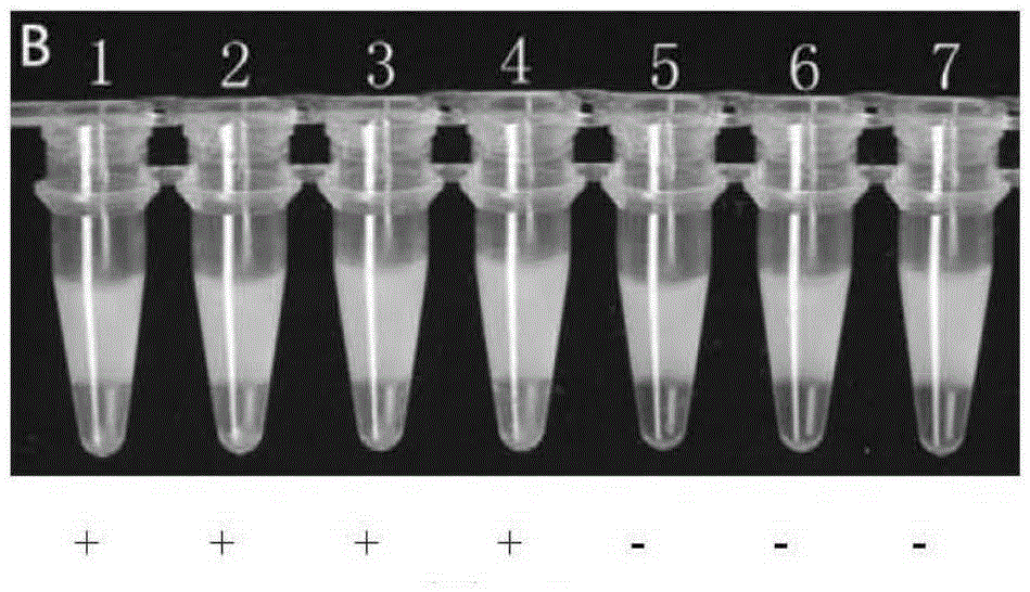 LAMP (loop-mediated isothermal amplification) kit for detection of mycoplasma pneumoniae and special LAMP primer for detection of mycoplasma pneumoniae