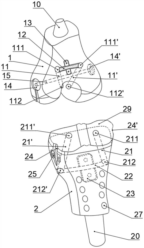 A hingeless ligament biomimetic tumor half/total knee joint prosthesis reconstruction system