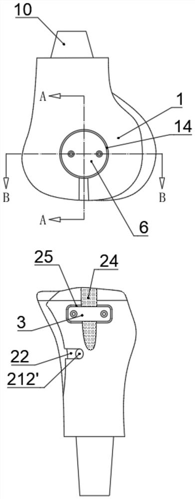 A hingeless ligament biomimetic tumor half/total knee joint prosthesis reconstruction system