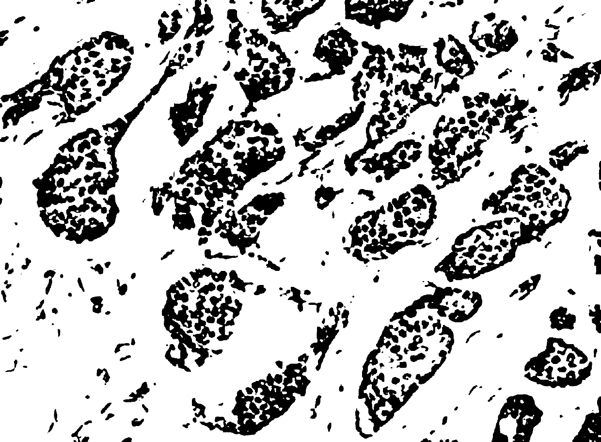 A breast cancer Ki67/ER/PR nuclear staining cell counting method based on staining separation