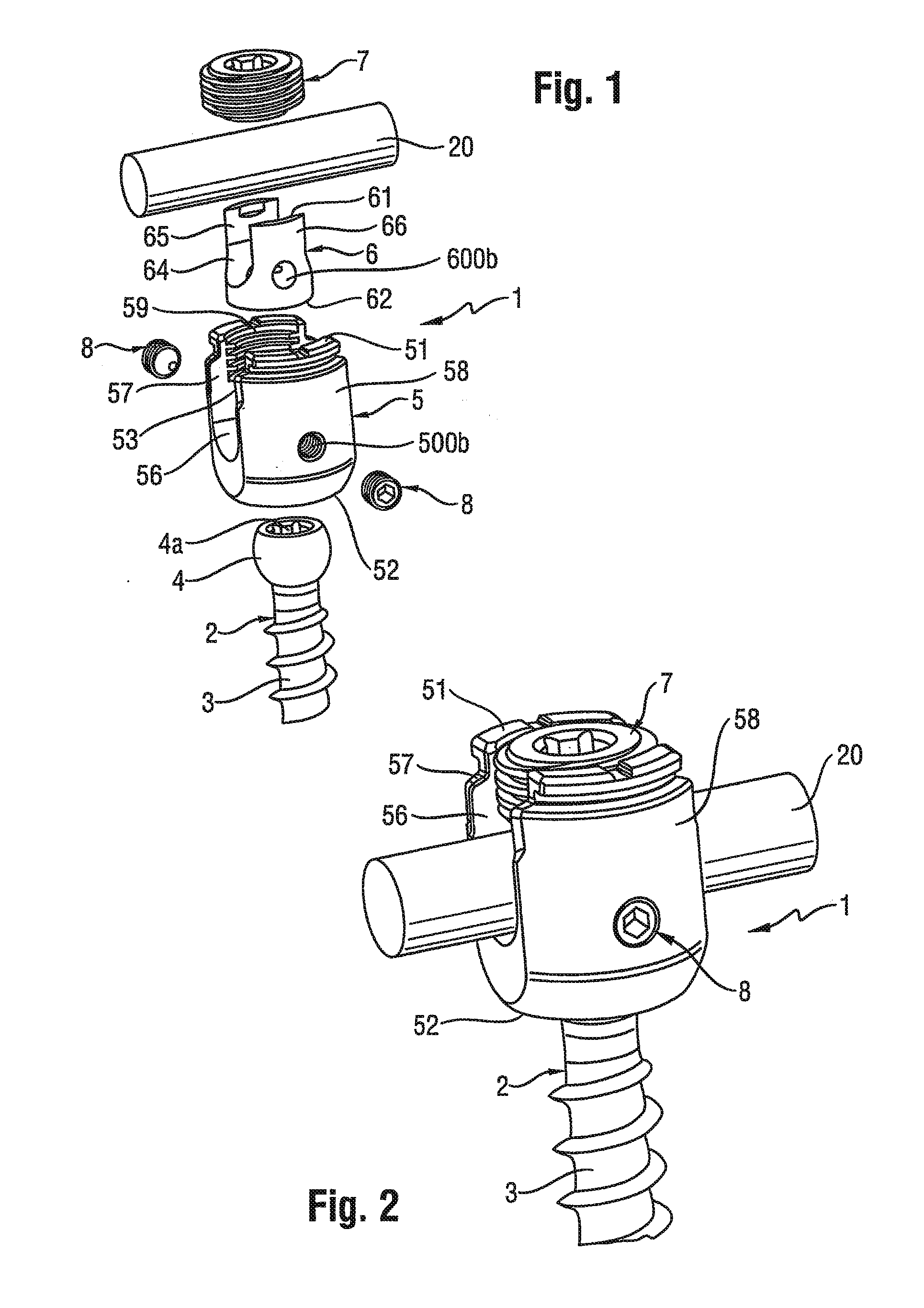 Polyaxial bone anchoring device