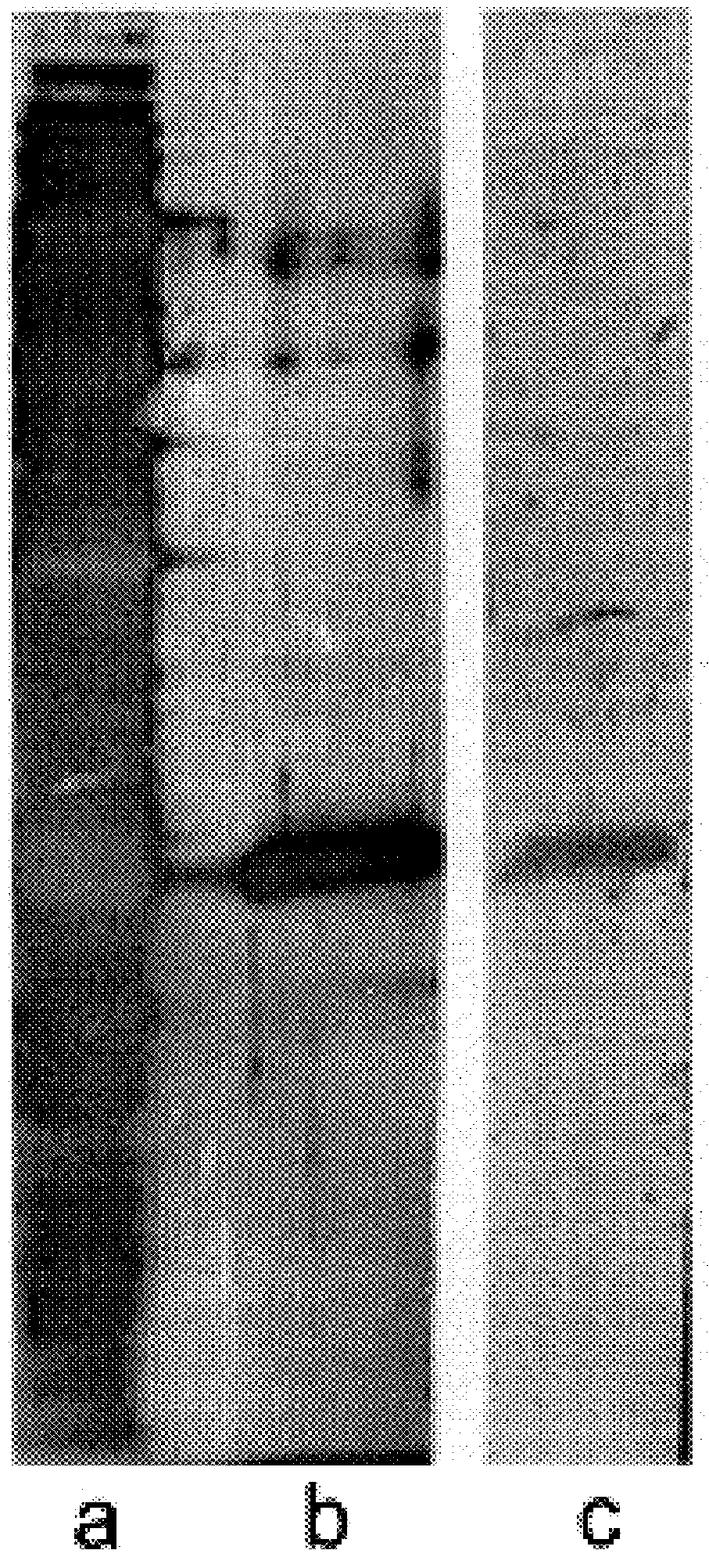 Detection of mycobacteria