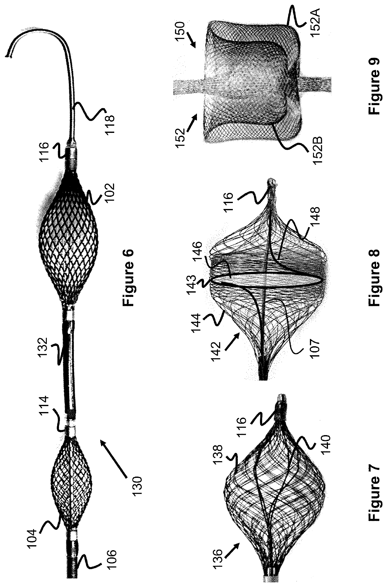 Temporary aortic occlusion device