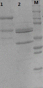 Recombinant virus-like particle (VLP) of human papilloma virus type 31 (HPV31) and preparation method thereof