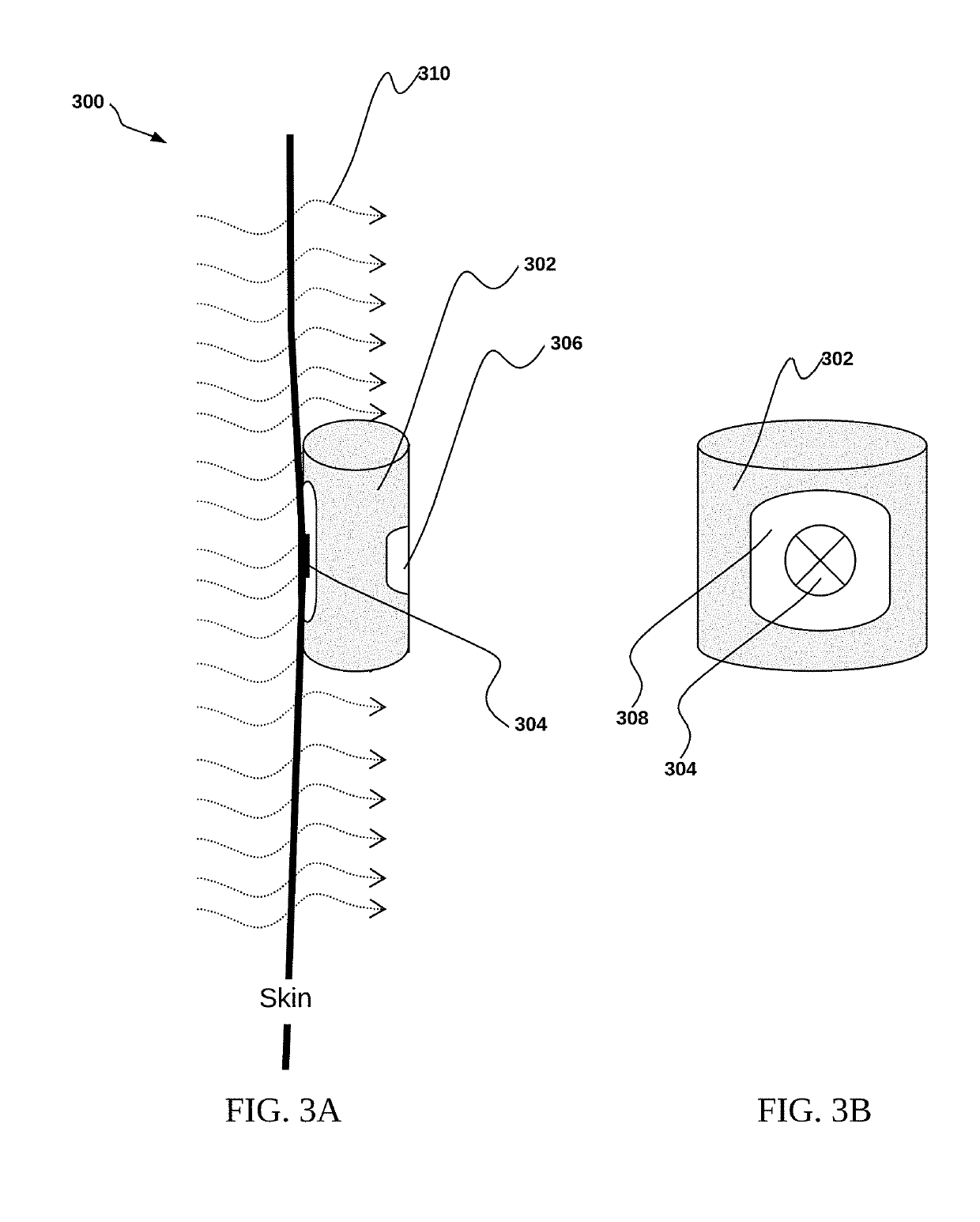 Systems and methods for managing sleep disorders