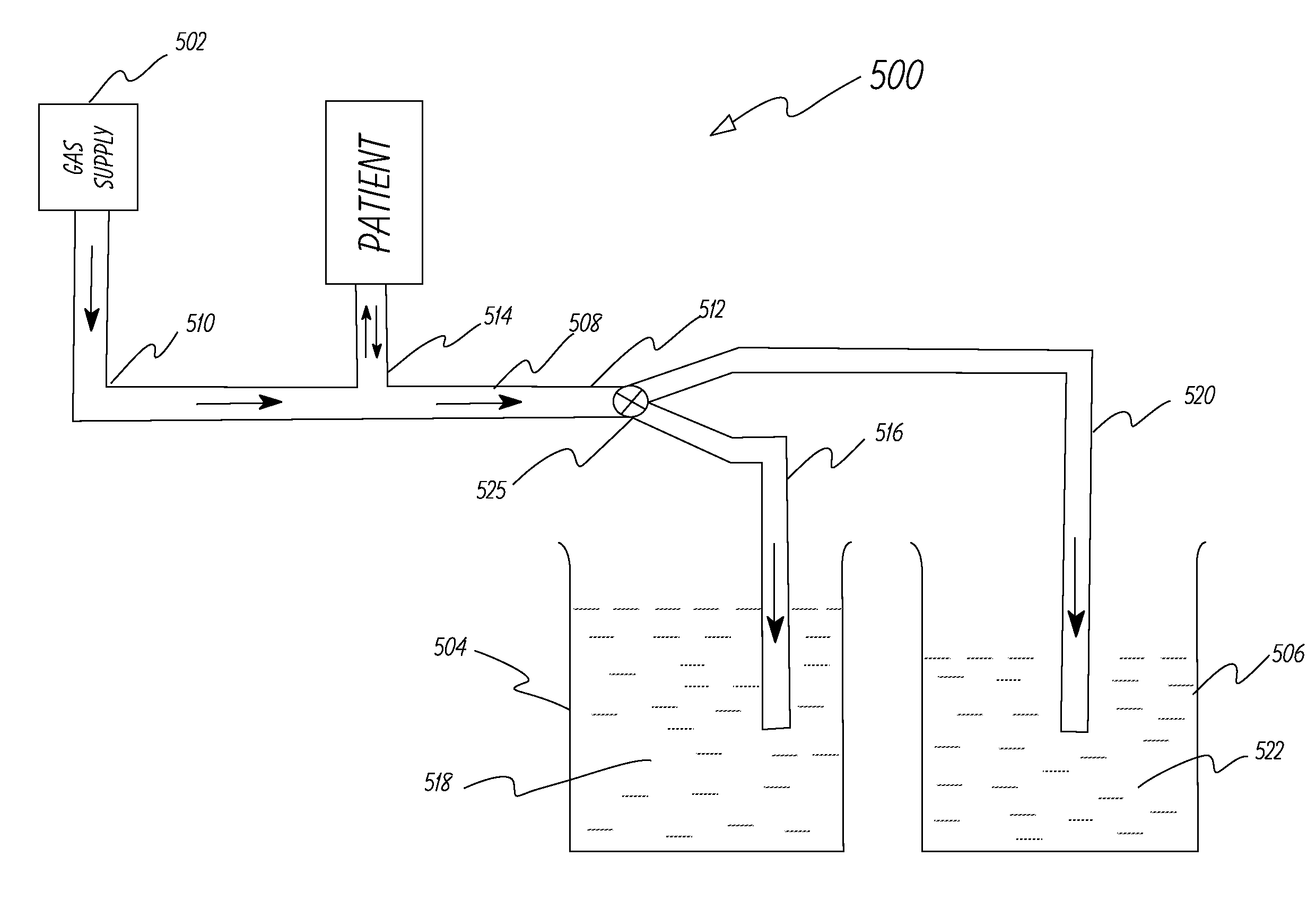 Apparatus and method to provide breathing support