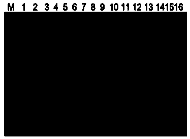 LAMP detection primer composition for phytophthora infestans and LAMP detection kit and LAMP detection method of LAMP detection primer composition