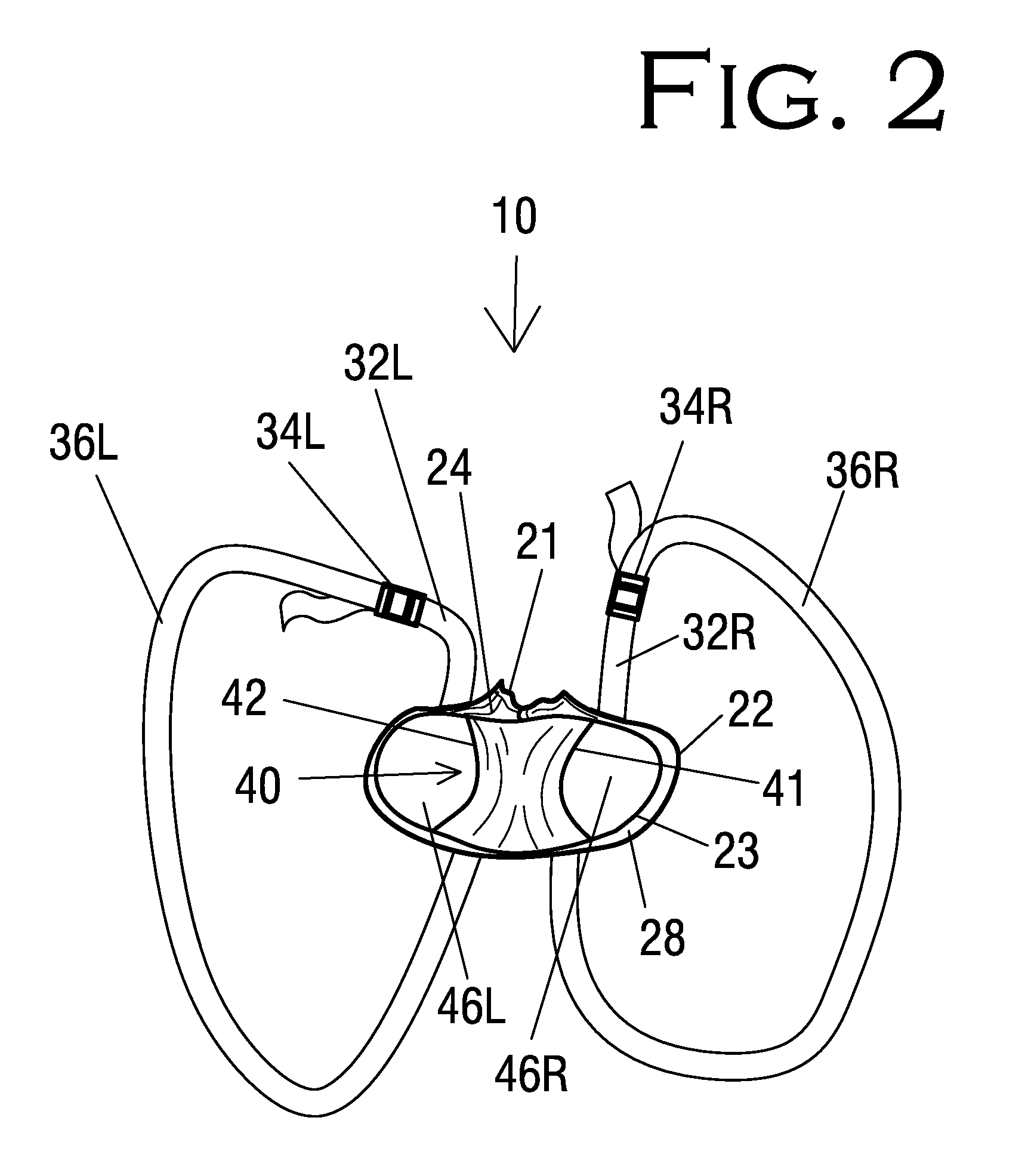 Attendant-Assisting Baby Walker