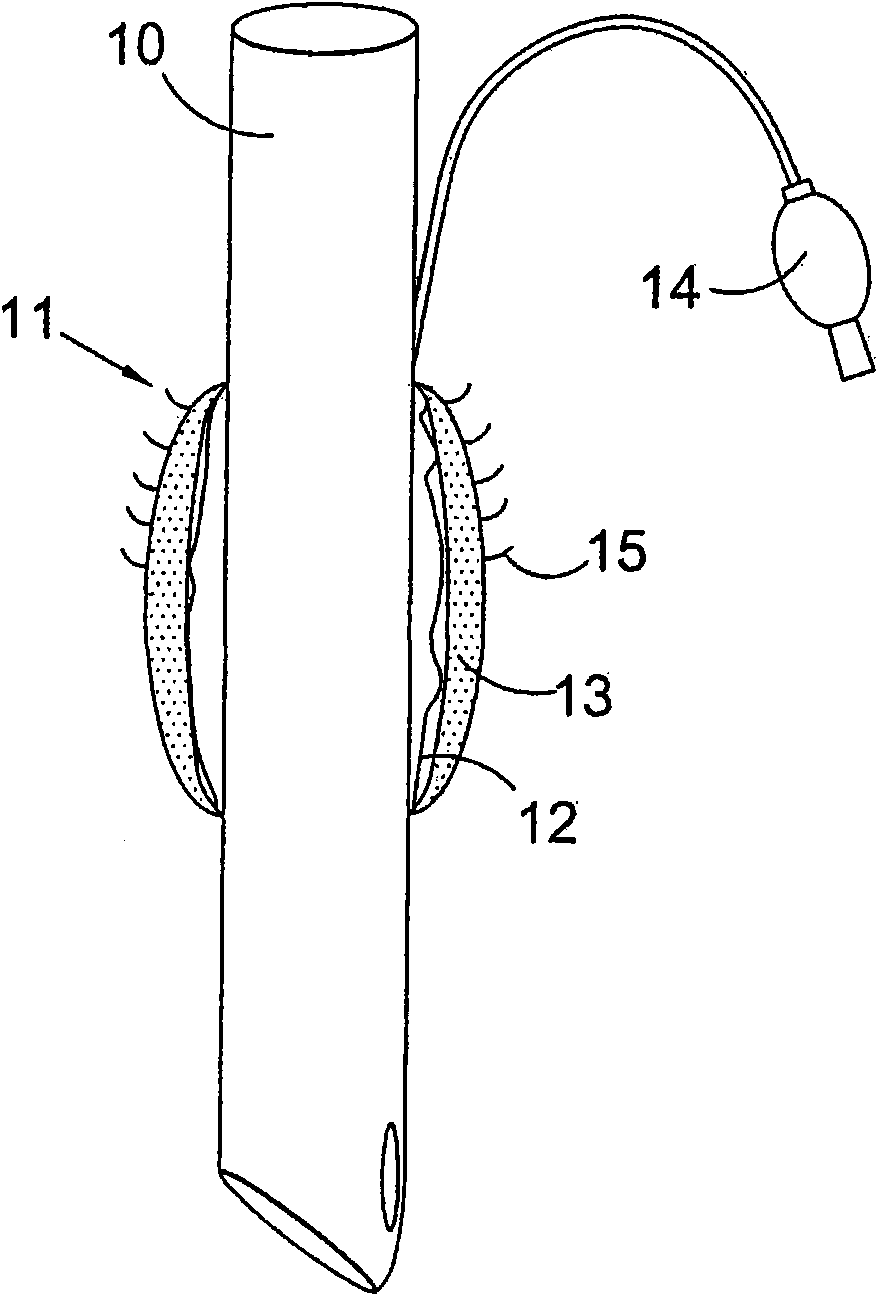 Airway device