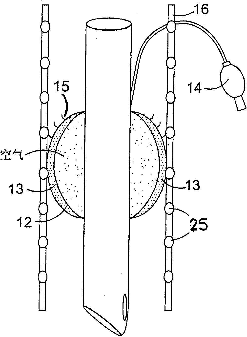 Airway device