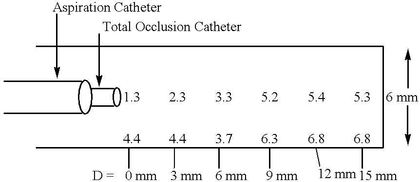 Methods for enhancing fluid flow through an obstructed vascular site, and systems and kits for use in practicing the same