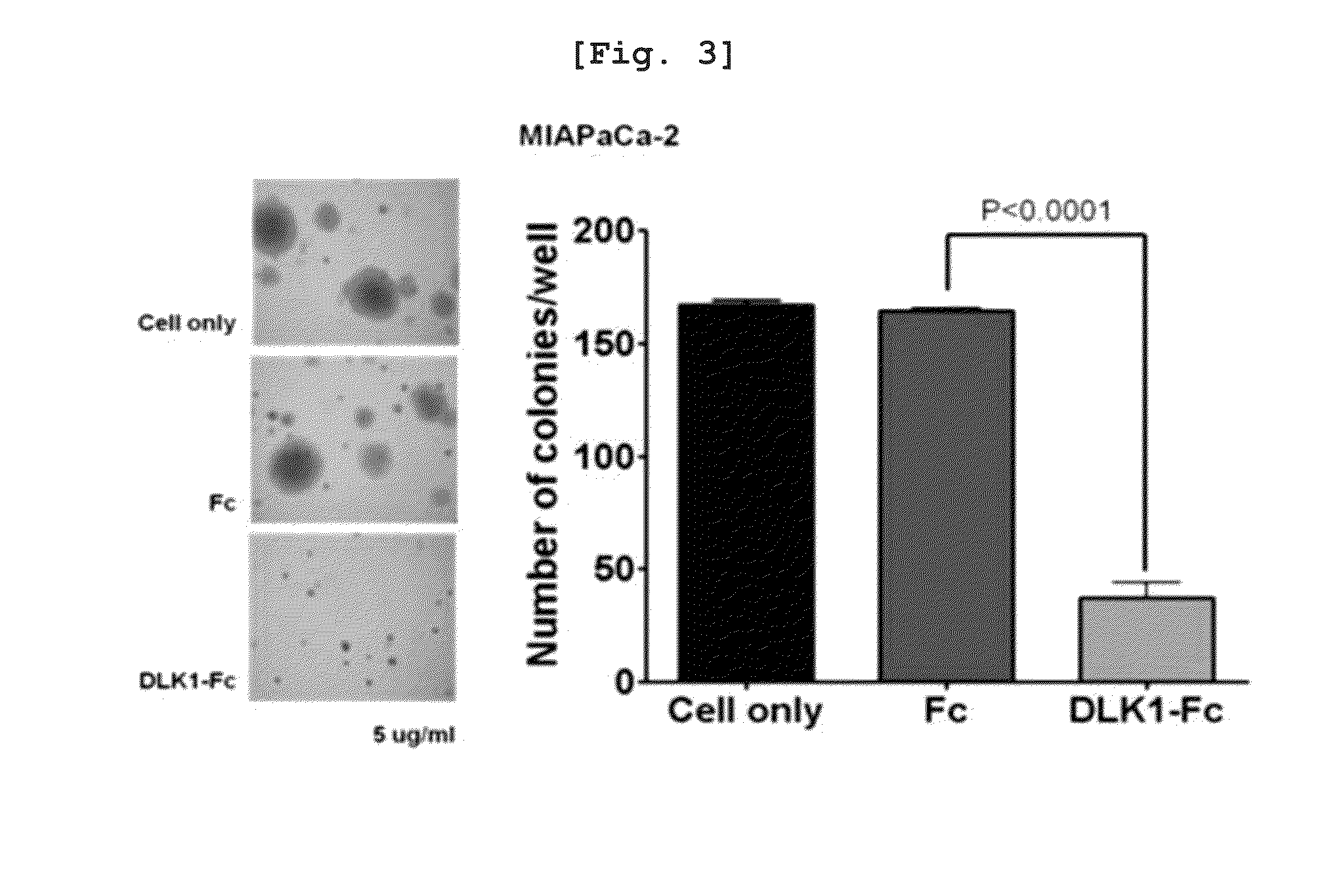 Activin Receptor Type II B Inhibitors Comprising DLK1 Extracellular Water-Soluble Domain