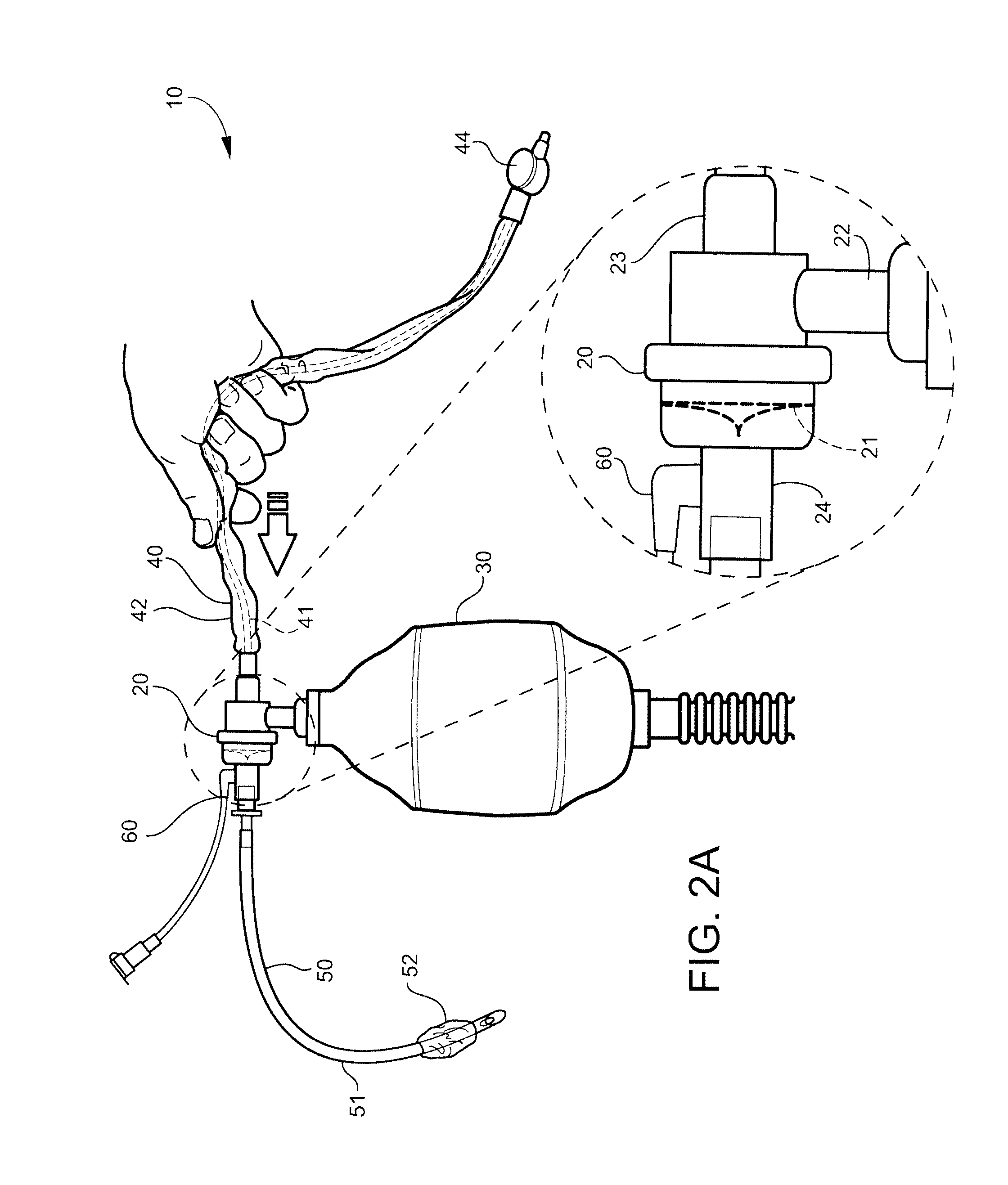 Device having manual resuscitation and suction capabilities