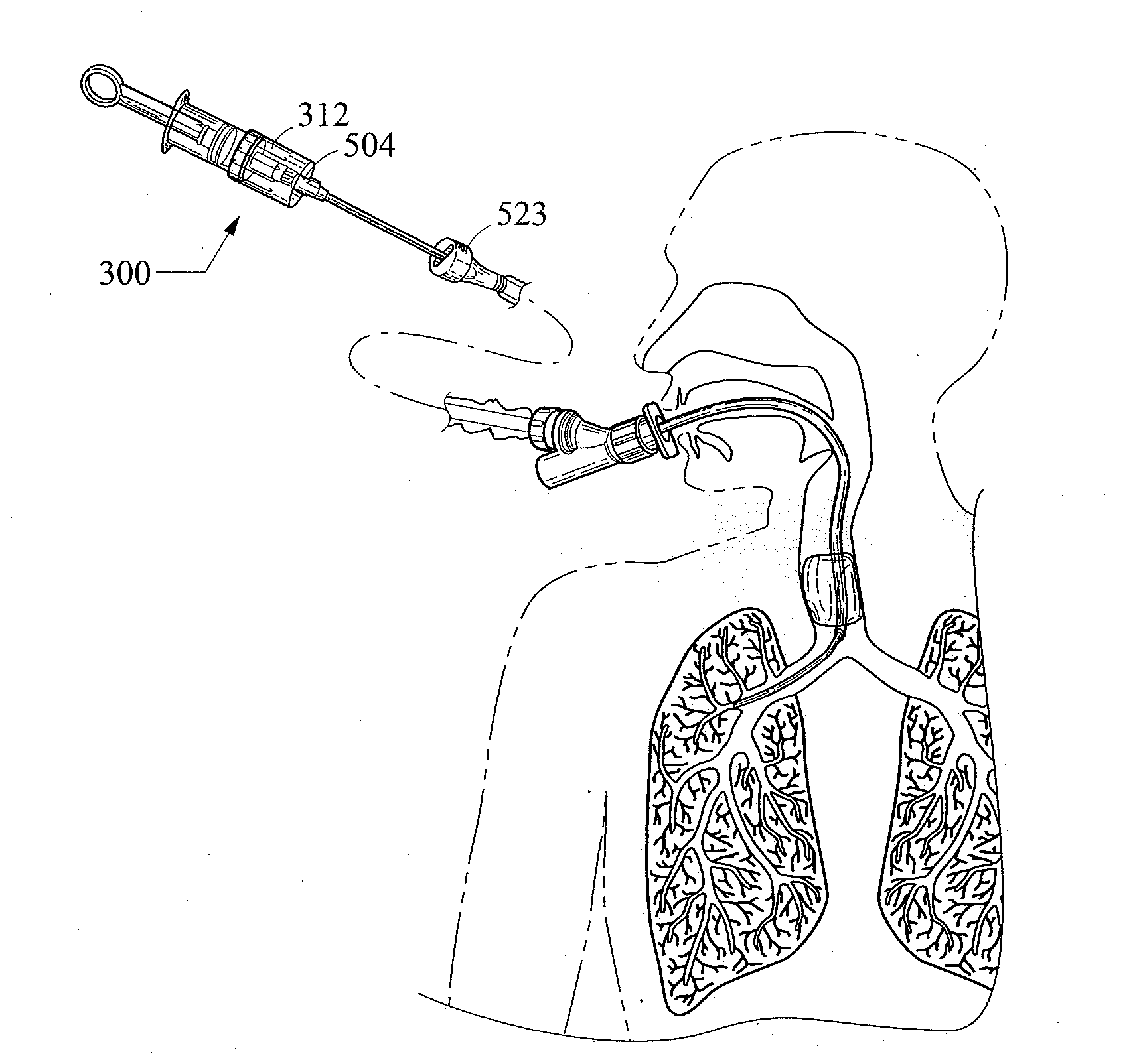 Diagnostic sample collection system and method of use