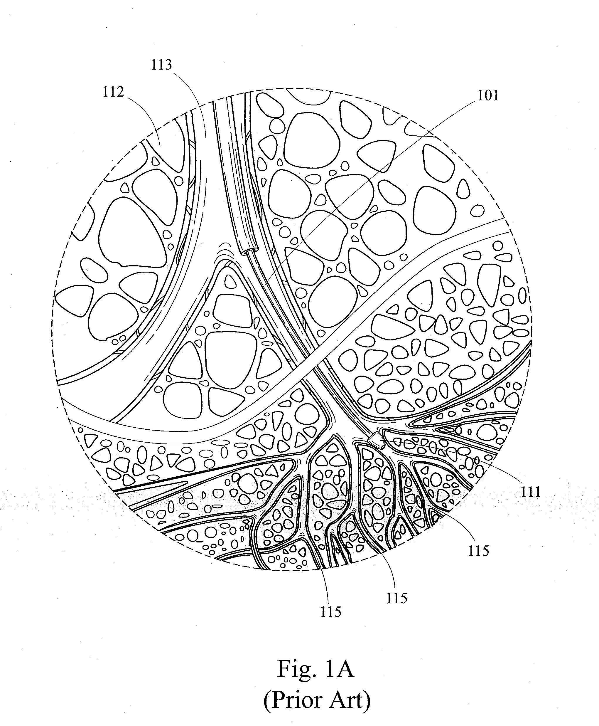 Diagnostic sample collection system and method of use