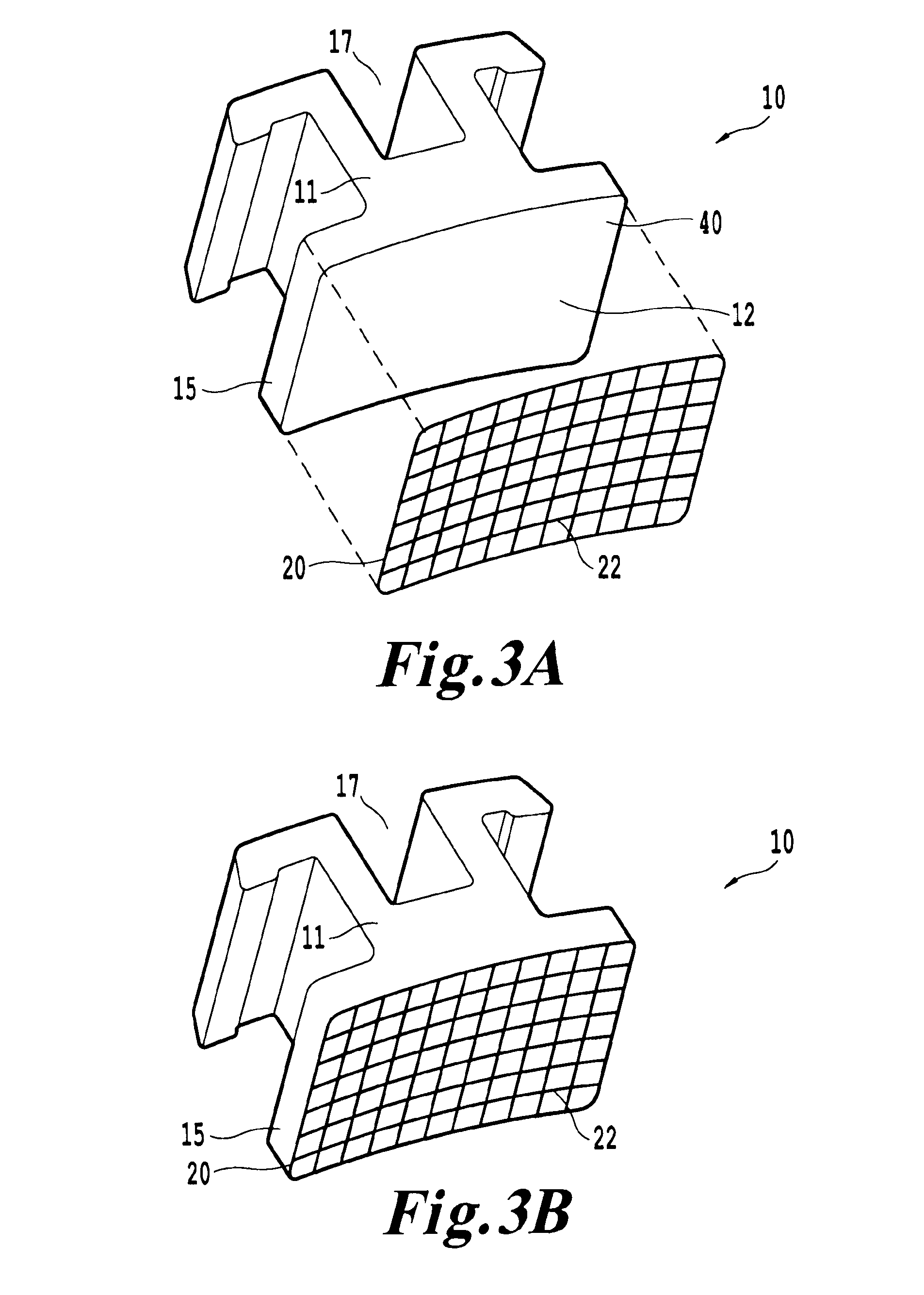 Metal mesh on ceramic bracket; ceramic bracket with metal insert; metal bracket with tooth-colored coating; self-legating, low profile, metal bracket; and methods of making same