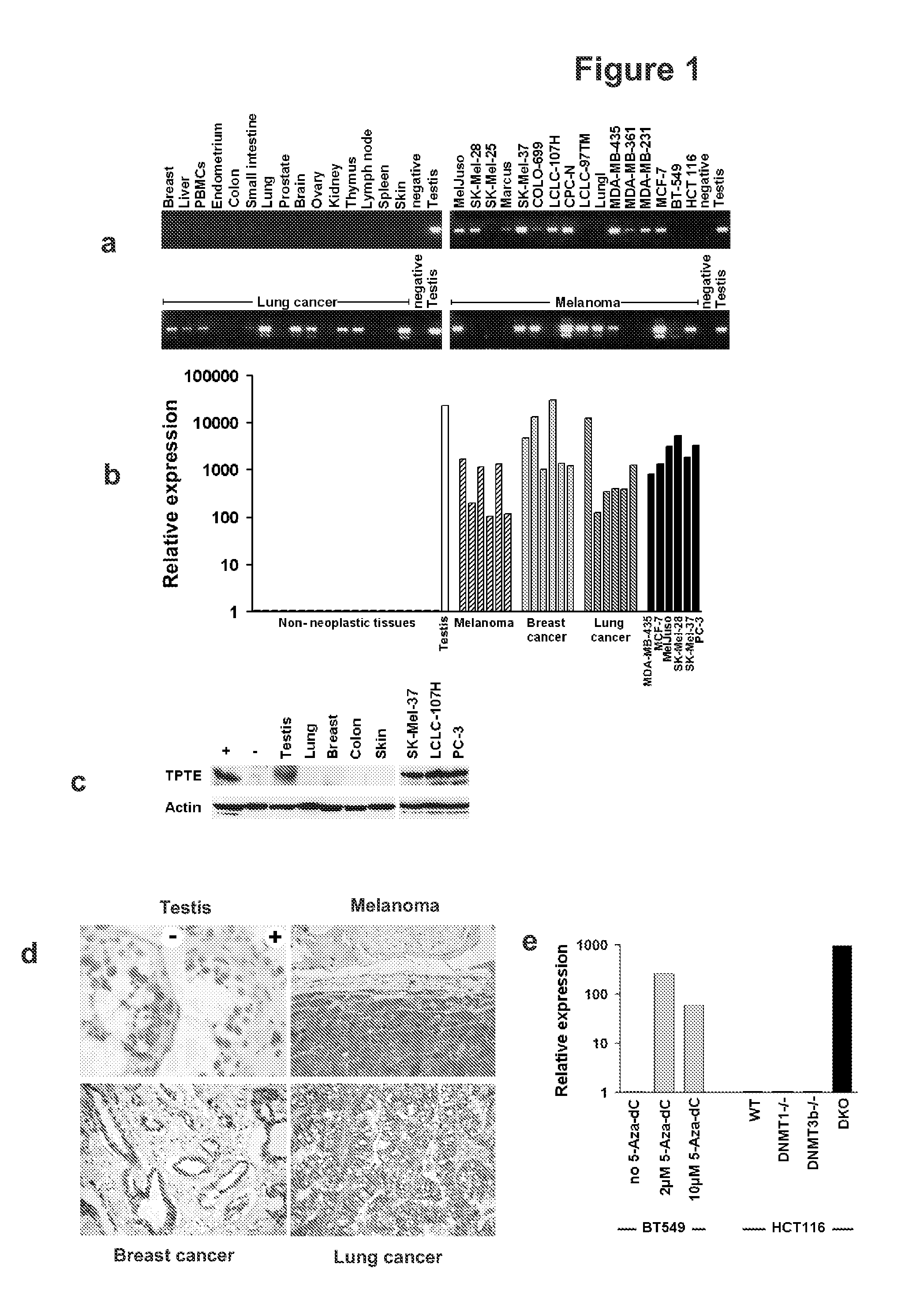 Compositions and methods for therapy and diagnosis of cancer and cancer metastasis