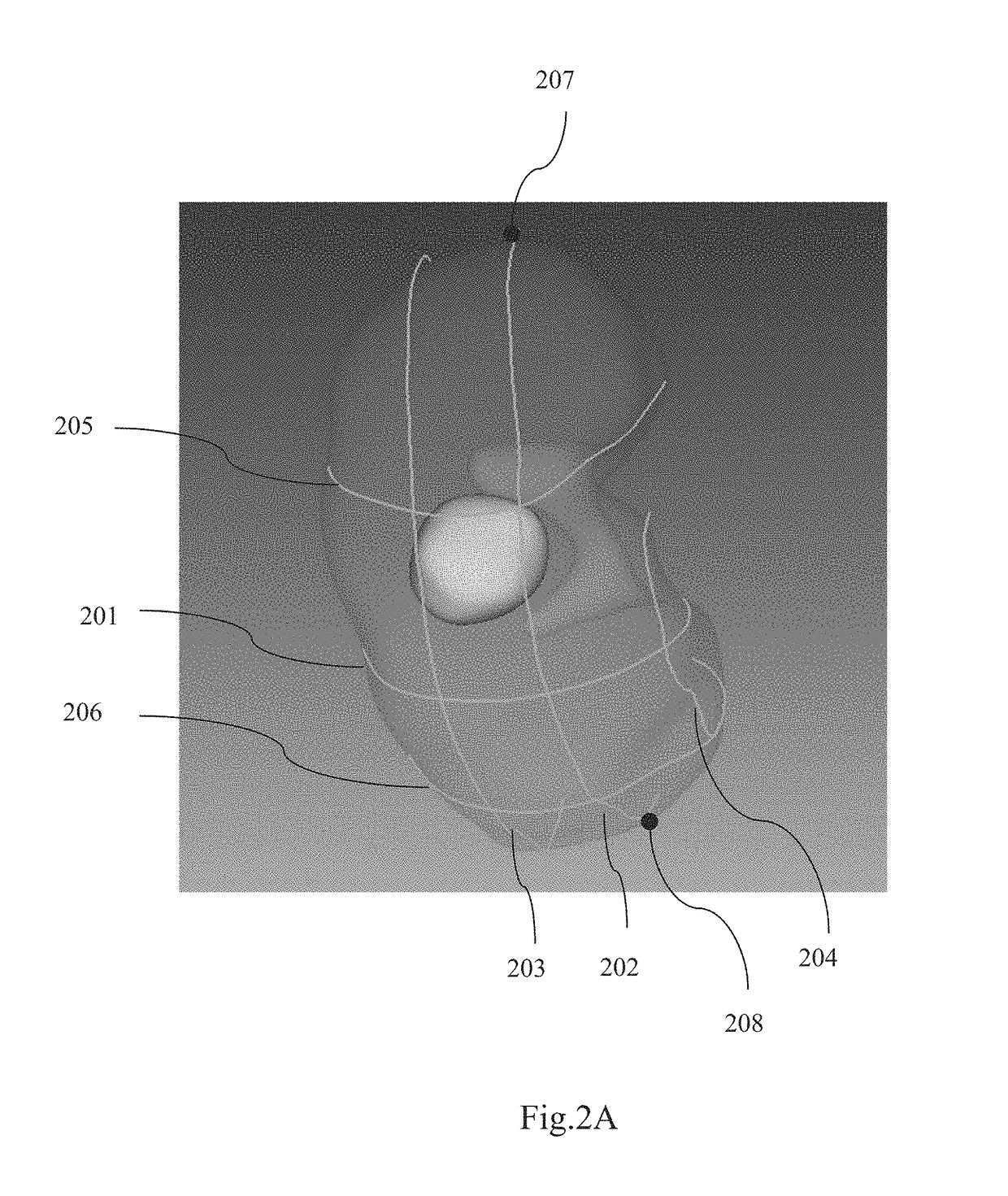 Method and system for interactive grid placement and measurements for lesion removal