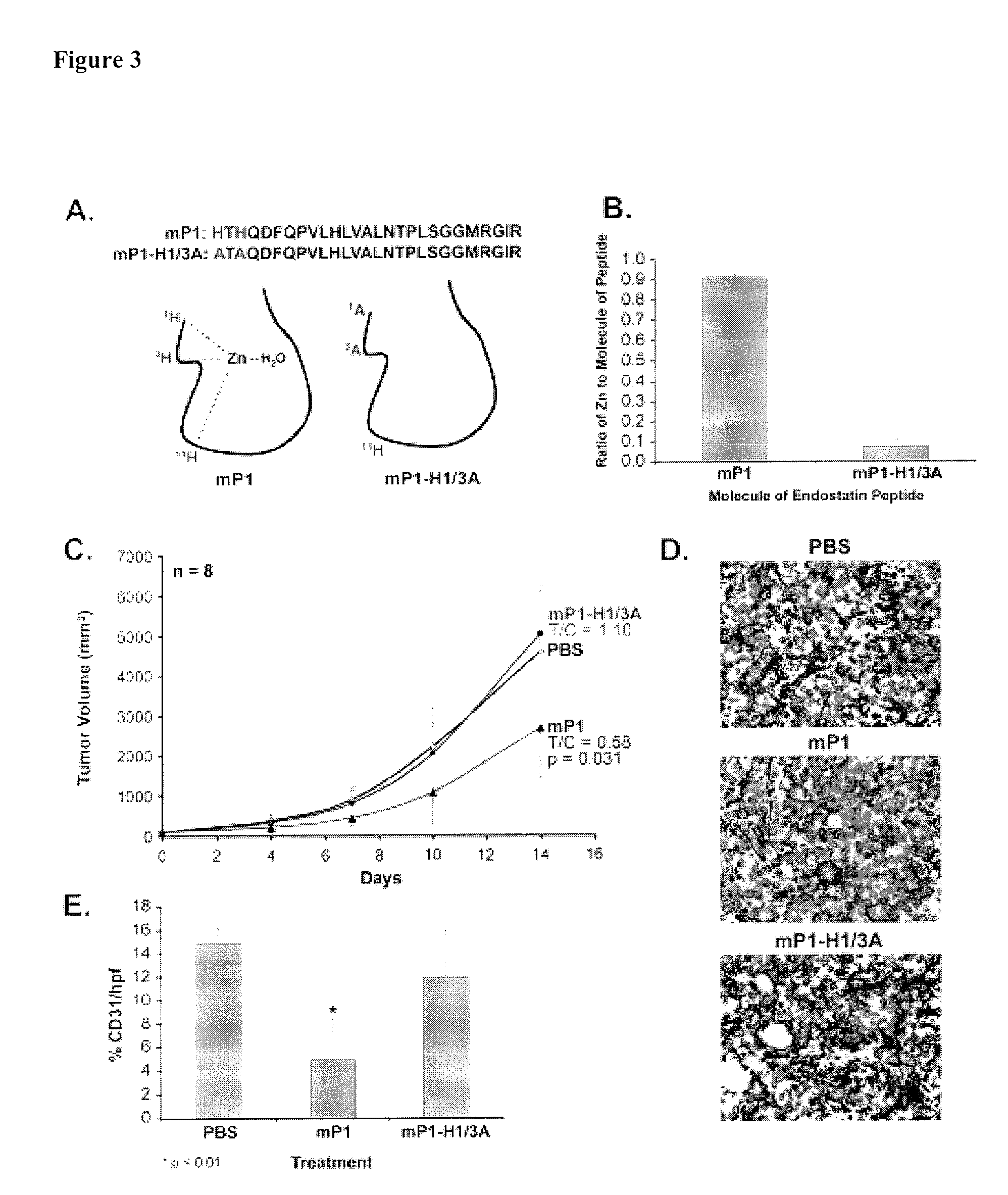 Anti-angiogenic peptides for treating or preventing endometriosis