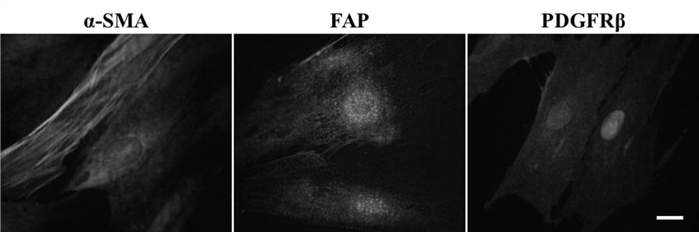 Nucleic acid aptamer for targeting tumor-associated fibroblasts and application of nucleic acid aptamer