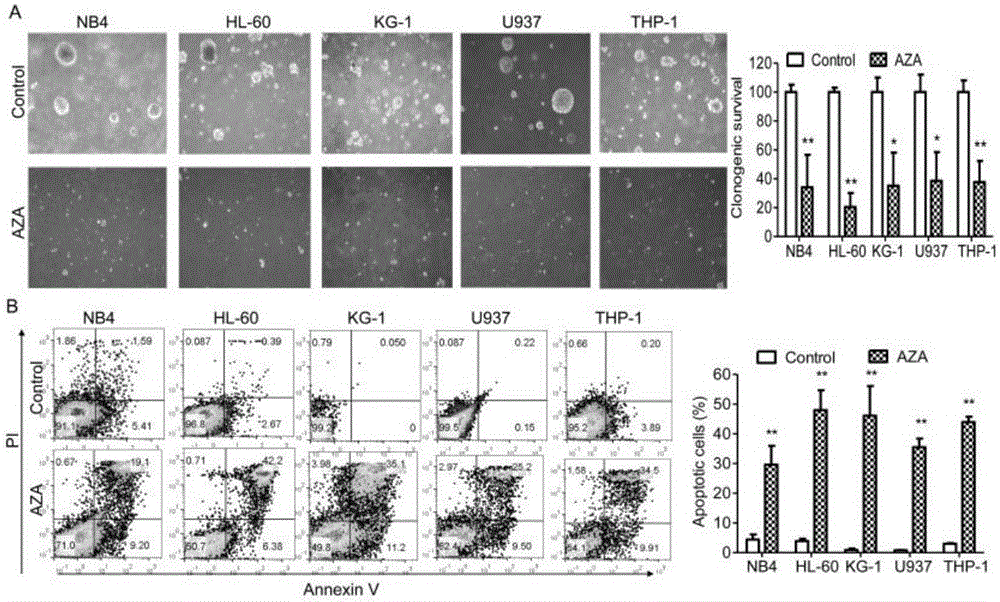 Application of AZA (Azelaic Acid) in preparation of AML (Acute Myeloid Leukemia) resistant and chemosensitization drugs