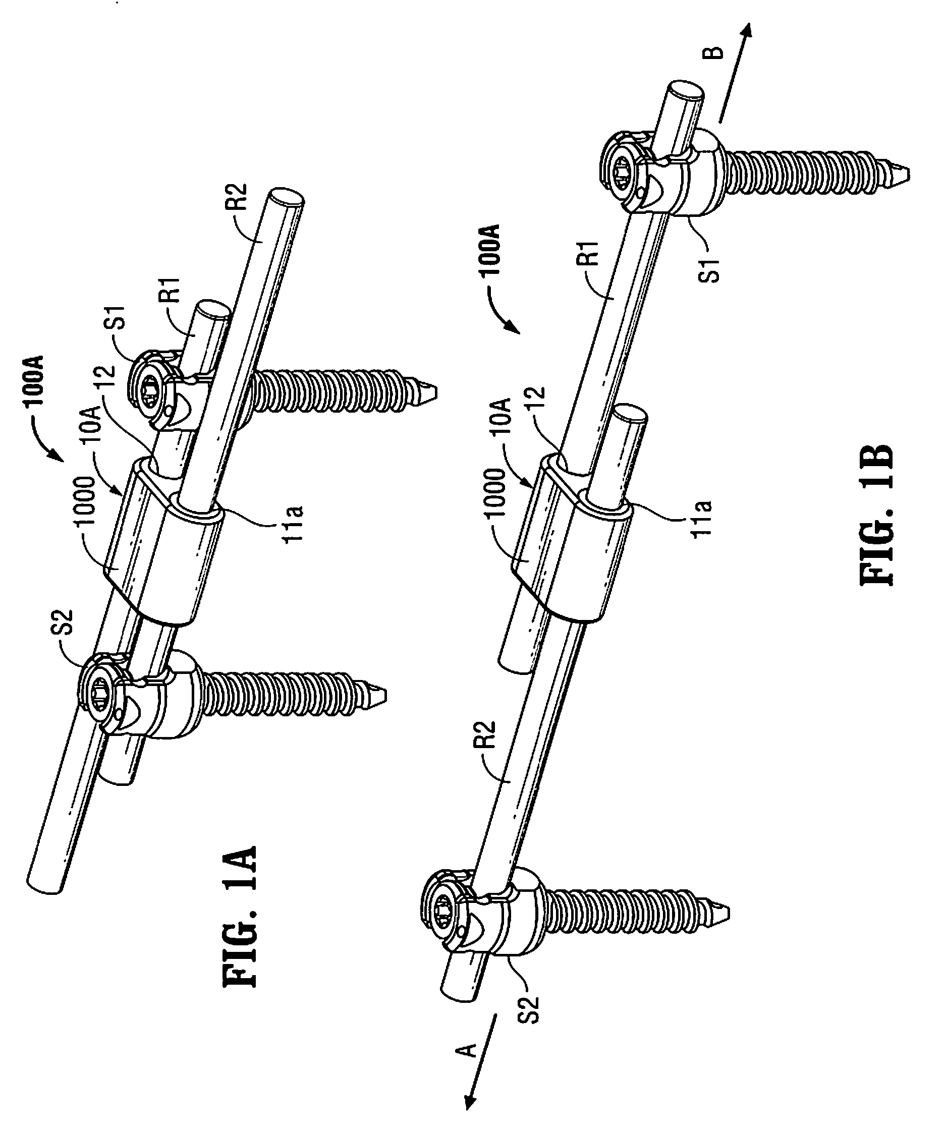 Automatic lengthening bone fixation device