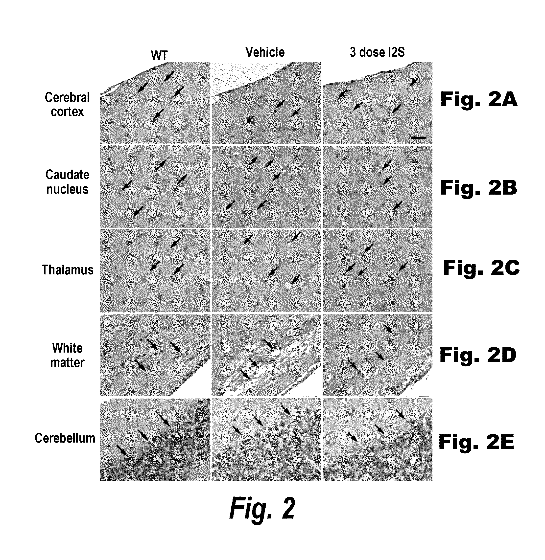 Methods and compositions for CNS delivery of iduronate-2-sulfatase