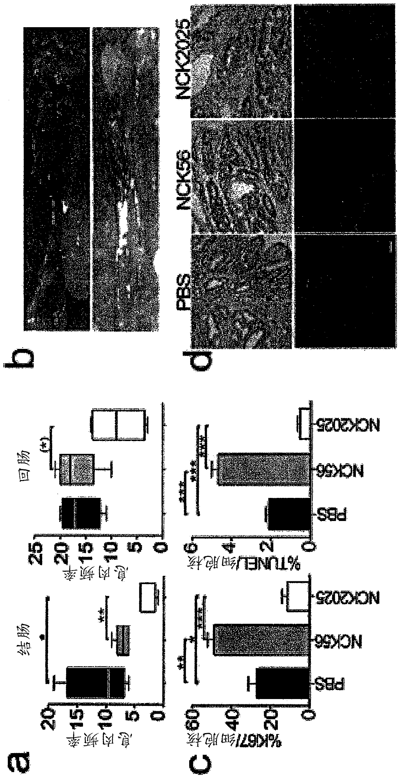 Methods to reduce polyposis and colorectal cancer