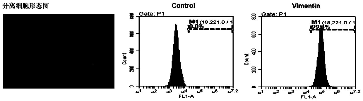 Mouse fibroblast strain capable of conditionally overexpressing HPV E7 and application thereof