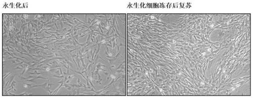 Mouse fibroblast strain capable of conditionally overexpressing HPV E7 and application thereof