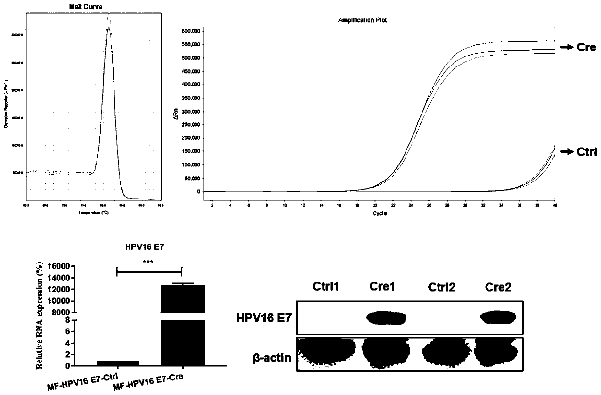 Mouse fibroblast strain capable of conditionally overexpressing HPV E7 and application thereof